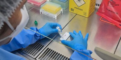Anvisa impõe novas normas a laboratórios de controle; prazo de 1 ano