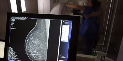 ANS determina: planos cobrirão mamografia digital para todas as idades