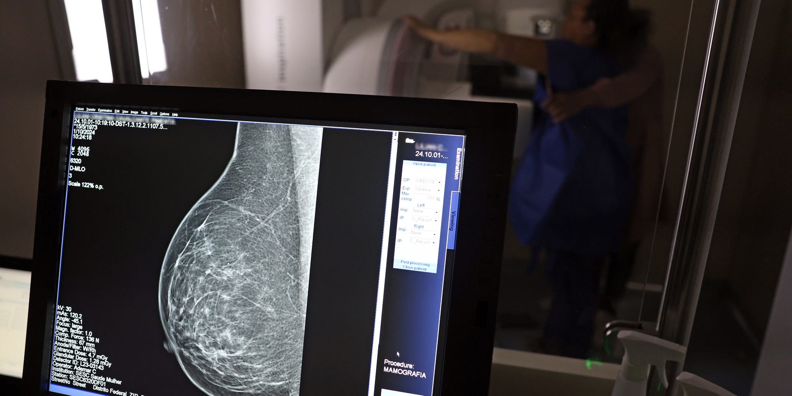 ANS determina: planos cobrirão mamografia digital para todas as idades