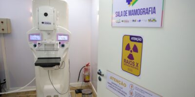 Homens detectam câncer de mama em estágios avançados, alertam especialistas